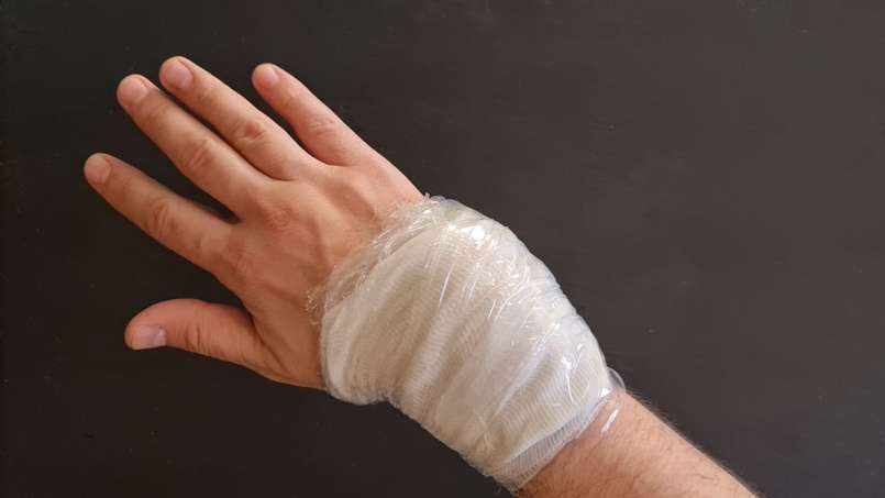 Obklad s lojem a zelnými listy, foto 7