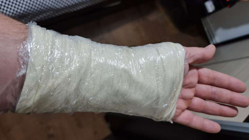 Obklad s lojem a zelnými listy, foto 8